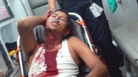 ¡Sangrienta riña dejó 2 lesionados en una fiesta en Aguascalientes!