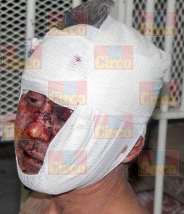 foto8-El asqueroso y desquiciado sujeto fue atendido por Cruz Roja