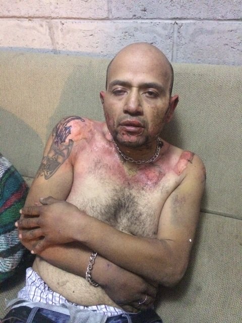 ¡Comerciante fue quemado intencionalmente por su compañero de parranda en Aguascalientes!