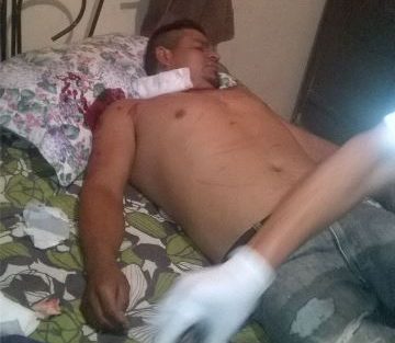 ¡Adicto desempleado intentó suicidarse degollándose con un vidrio en Aguascalientes!