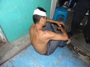 lesionado-picado-barrio-de-la-salud-3