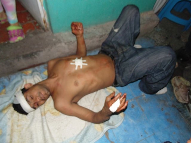 ¡Albañil fue apuñalado con un picahielo y golpeado con un tubo en Aguascalientes!