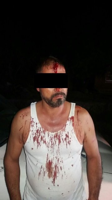 ¡Joven fue baleada durante una riña en Aguascalientes; su atacante fue detenido!
