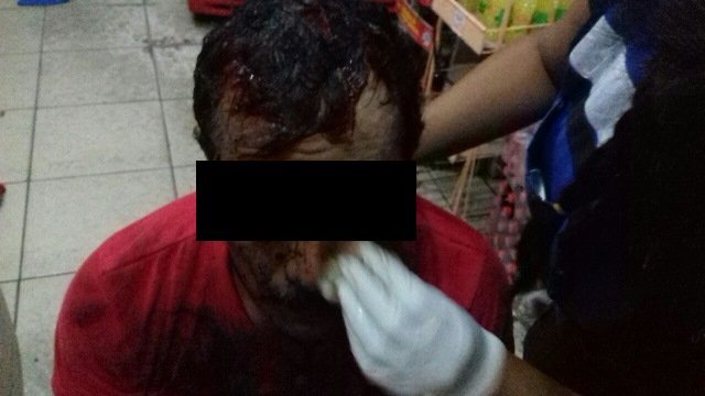 ¡3 lesionados y 2 detenidos tras una riña en Jesús María, Aguascalientes!