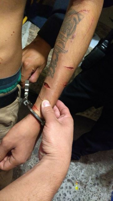¡Adolescente se provocó 18 heridas con un gollete de botella al intentar matarse en Aguascalientes!