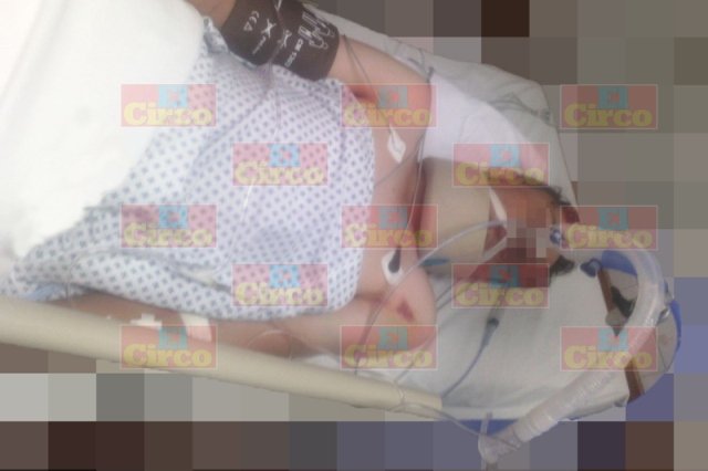 ¡Adolescente murió tras una caída de su motocicleta en Lagos de Moreno!