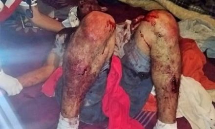 ¡Hombre se salvó de ser asesinado a machetazos por sus vecinos en Aguascalientes!