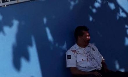 ¡Sujeto lesionó a un policía municipal de Aguascalientes tras golpearlo en la cabeza con unas pinzas!