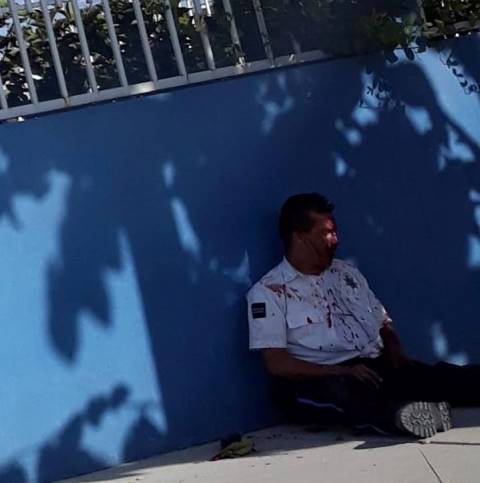 ¡Sujeto lesionó a un policía municipal de Aguascalientes tras golpearlo en la cabeza con unas pinzas!