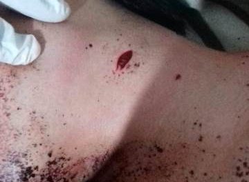 ¡Adolescente, paciente psiquiátrico, intentó matarse hiriéndose en el cuello con un cutter en Aguascalientes!