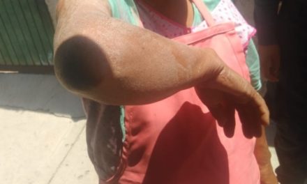 ¡Flamazo en un negocio de comida dejó 2 mujeres quemadas en Aguascalientes!