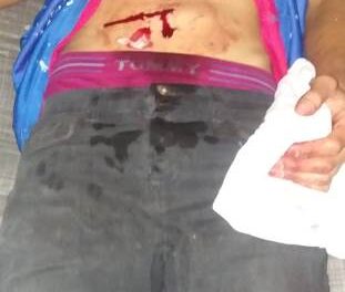 ¡Joven fue herido apuñalado durante una riña en Aguascalientes!