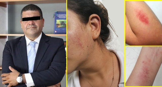 ¡Comandante de la Policía Municipal de Aguascalientes golpeó a su pareja sentimental!