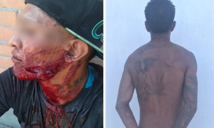 ¡Joven fue herido de un machetazo en la cara tras una riña en Aguascalientes!